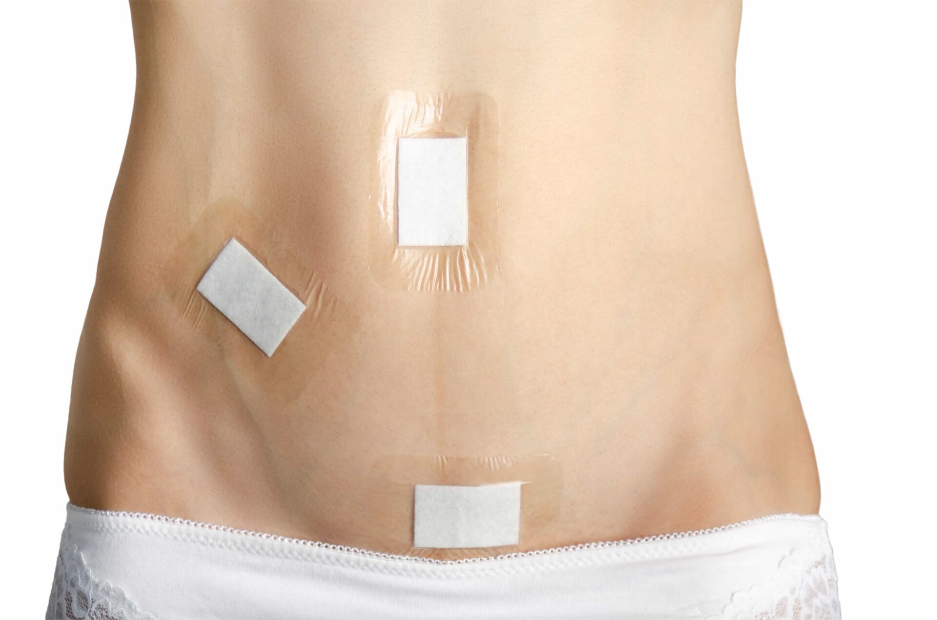 laparoscopic surgery